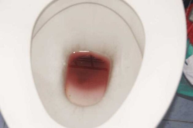 крывяністыя вылучэнні ў мужчын пры ўзбуджэнні